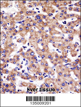SULT1A3 Antibody (Center)