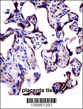 KCNA2 Antibody (C-term)