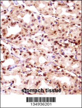 TMPO Antibody (N-term)