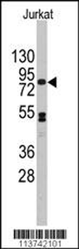 CDH12 Antibody (N-term)