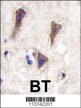 CDH12 Antibody (N-term)