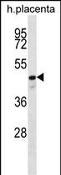 CXorf39 Antibody (C-term)
