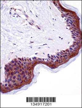 LSM14A Antibody (C-term)