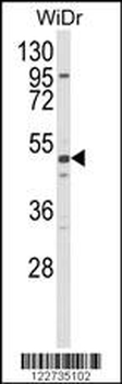 ALDH5A1 Antibody