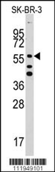 ALDH5A1 Antibody (C-term)