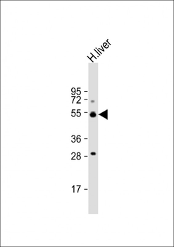 ALDH5A1 Antibody (N-term)