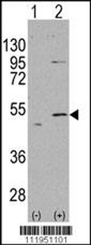 ALDH5A1 Antibody (N-term)