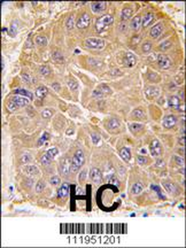 ALDH5A1 Antibody (N-term)