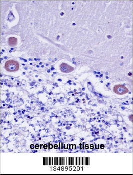 KDELR2 Antibody (C-term)