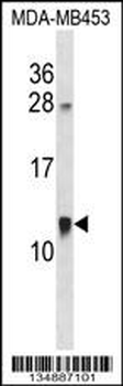 ACBD7 Antibody (C-term)