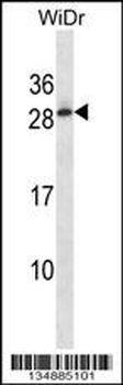 CATSPERTZ Antibody (C-term)