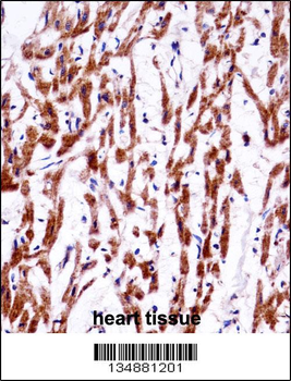 TMM85 Antibody (N-term)