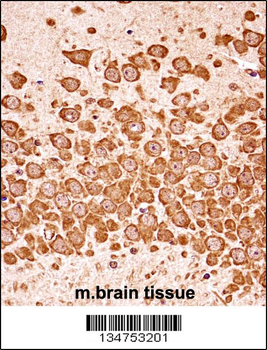 Mouse Dapk3 Antibody (Center)