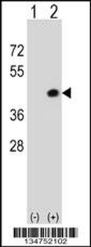 Mouse Dapk2 Antibody (N-term)
