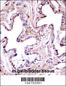 Mouse Akt1 Antibody (N-term)