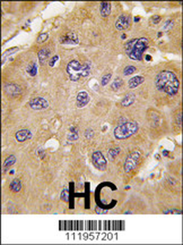 ALDH6A1 Antibody (C-term)