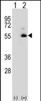 ALDH3A2 Antibody