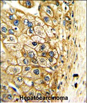 ALDH3A2 Antibody