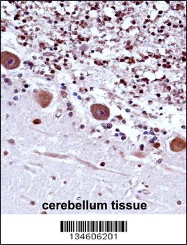 TRA2B Antibody (Center)