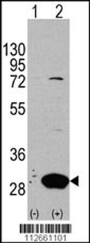 Latexin Antibody (Center)