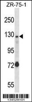 UBE4A Antibody (Center)