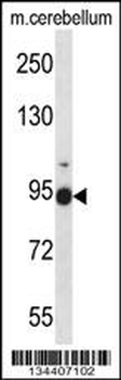 FBLN1 Antibody (C-term)