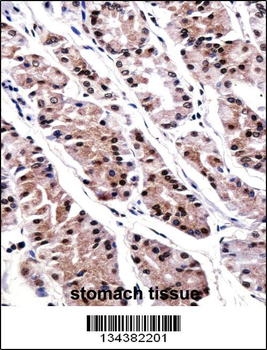 RUNX3 Antibody (Center)