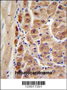 ALDH1A1 Antibody