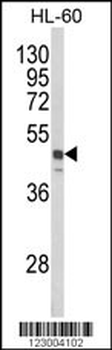 SNX6 Antibody