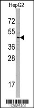 SNX6 Antibody (N-term)