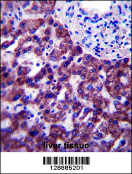 OR14J1 Antibody (C-term)