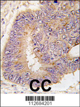 PDE8A Antibody (Center) (L572)