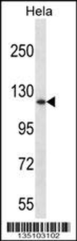 DNMT3A Antibody (Center R478)