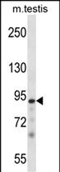 Mouse Pkn3 Antibody (N-term)