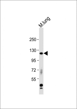 Mouse Epha2 Antibody (Center)