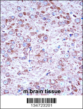 Mouse Aak1 Antibody (Center)