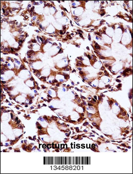 AIP Antibody (C-term)