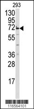 MIPEP Antibody (Center)