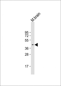 E2F3 Antibody (Center)
