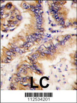 TRAPPC4 Antibody (N-term)