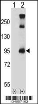 TRPC3 Antibody (C-term)