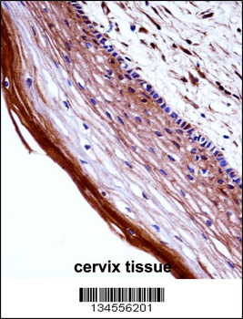 PGF Antibody (Center)