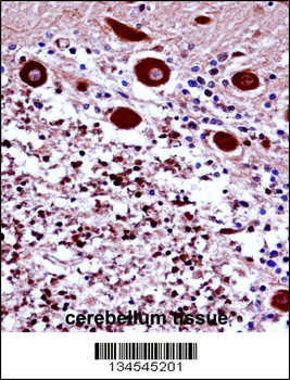 FREQ Antibody (N-term)