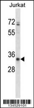 ART3 Antibody (C-term)