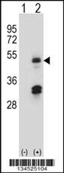 HAT1 Antibody (N-term)