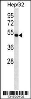 FDFT1 Antibody (C-term)