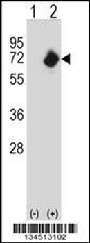 NMT2 Antibody (C-term)