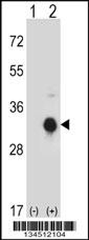 KLK10 Antibody (N-term)