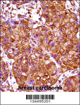 IRX3 Antibody (N-term)
