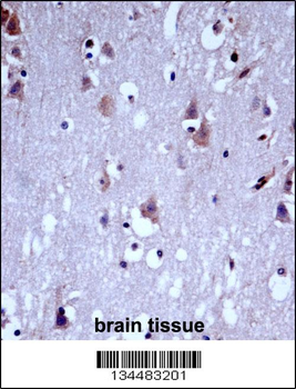 KCNC1 Antibody (C-term)